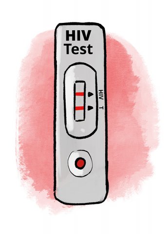 HIV-Test (positiv)